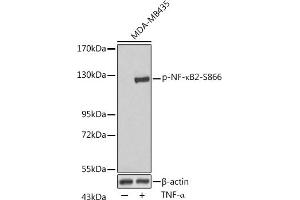 Western blot analysis of extracts of MDA-MB435 cells, using Phospho-NF-κB2-S866 antibody (ABIN3020402, ABIN3020403, ABIN3020404, ABIN1681895 and ABIN7101874) at dilution.