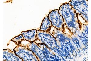ABIN6260071 and ABIN6273195 at 1/100 staining Mouse colorectal tissue by IHC-P.