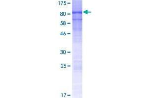 Image no. 1 for Guanylate Binding Protein 6 (GBP6) (AA 1-633) protein (GST tag) (ABIN1354890)