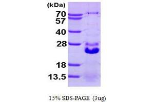 SDS-PAGE (SDS) image for Heat Shock 27kDa Protein Family, Member 7 (Cardiovascular) (HSPB7) (AA 1-170) protein (His tag) (ABIN667773) (HSPB7 Protein (AA 1-170) (His tag))