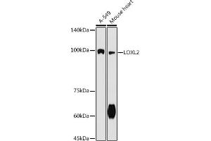 Western blot analysis of extracts of various cell lines, using LOXL2 antibody (ABIN7268349) at 1:500 dilution.