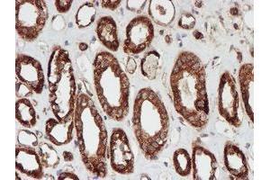 Immunohistochemical staining of paraffin-embedded Human Kidney tissue using anti-SCFD1 mouse monoclonal antibody. (SCFD1 anticorps)