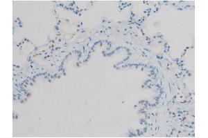 ABIN6267410 at 1/200 staining Rat lung tissue sections by IHC-P. (Connexin 43/GJA1 anticorps  (pSer368))