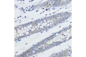 Immunohistochemistry of paraffin-embedded human colon using MonoMethyl-Histone H4-K20 antibody (ABIN3016044, ABIN3016045, ABIN3016046, ABIN1680258 and ABIN6219531) at dilution of 1:200 (40x lens). (Histone H4 anticorps  (meLys20))