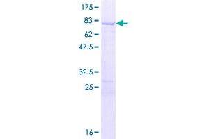 Image no. 1 for Polypyrimidine Tract Binding Protein 1 (PTBP1) (AA 1-557) protein (GST tag) (ABIN1316690)