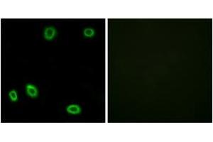 Immunofluorescence analysis of HuvEc cells, using OR5L1/2 Antibody. (OR5L1/2 anticorps  (AA 55-104))