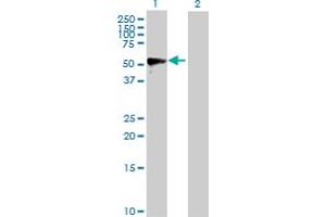 Western Blot analysis of MMP1 expression in transfected 293T cell line by MMP1 MaxPab polyclonal antibody. (MMP1 anticorps  (AA 1-469))