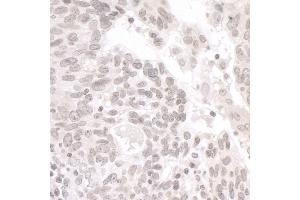 Immunohistochemistry (IHC) image for anti-Partner and Localizer of BRCA2 (PALB2) (AA 675-725) antibody (ABIN7454733)