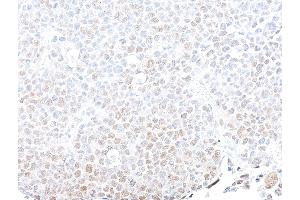 Immunohistochemistry (IHC) image for anti-SWI/SNF Related, Matrix Associated, Actin Dependent Regulator of Chromatin, Subfamily B, Member 1 (SMARCB1) (AA 225-275) antibody (ABIN7795717)