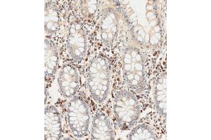 Immunohistochemical analysis of paraffin-embedded human colon tissue using (ABIN655251 and ABIN2844850) performed on the Leica® BOND RXm.