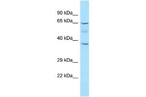 WB Suggested Anti-KRT77 Antibody Titration: 1. (Keratin 77 anticorps  (C-Term))