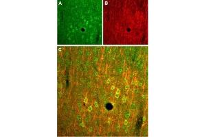 Expression of NMDA receptor 2B in rat cortex - Immunohistochemical staining of rat parietal cortex frozen sections stained with Anti-NMDAR2B (GluN2B) (extracellular) Antibody (ABIN7043230, ABIN7044326 and ABIN7044327), (1:100).
