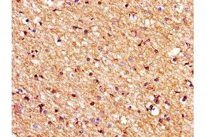 IHC image of ABIN7175545 diluted at 1:200 and staining in paraffin-embedded human brain tissue performed on a Leica BondTM system. (PROS1 anticorps  (AA 42-676))