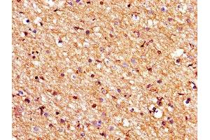 IHC image of ABIN7175545 diluted at 1:200 and staining in paraffin-embedded human brain tissue performed on a Leica BondTM system.