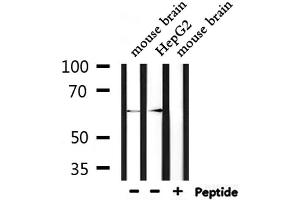 Western blot analysis of extracts from mouse brain and HepG2, using STIP1  Antibody.