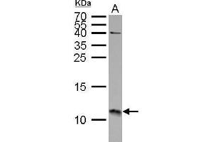 WB Image S100A11 antibody detects S100A11 protein by Western blot analysis. (S100A11 anticorps)