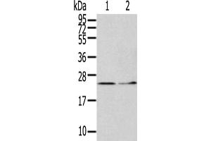 Gel: 12 % SDS-PAGE,Lysate: 40 μg,Lane 1-2: Hela cells, Human fetal liver tissue,Primary antibody: ABIN7127970(ITPA Antibody) at dilution 1/400 dilution,Secondary antibody: Goat anti rabbit IgG at 1/8000 dilution,Exposure time: 5 minutes (ITPA anticorps)