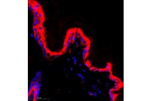 Immunofluorescence of paraffin embedded rat skin using CK13 (ABIN7074411) at dilution of 1:500 (400x lens) (Cytokeratin 13 anticorps  (C-Term))