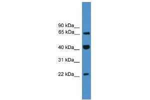 WB Suggested Anti-TCEAL6 Antibody Titration:  0. (TCEAL6 anticorps  (C-Term))