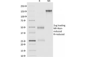 SDS-PAGE Analysis Purified Annexin A1 Mouse Monoclonal Antibody (ANXA1/1671).