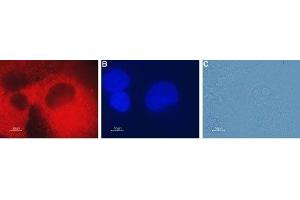 Expression of CLIC4 in human pancreatic carcinoma PANC-1 cells - Immunocytochemical staining of fixed and permeabilized human pancreatic carcinoma PANC-1 cells.