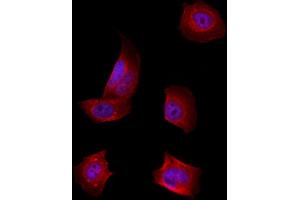ABIN6259216 and ABIN6274132 staining Hela by IF/ICC.