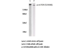 Western blot (WB) analysis of p-mTOR antibody in extracts from A549 and Hela cells. (MTOR anticorps  (pSer2448))