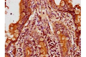 IHC image of ABIN7143136 diluted at 1:500 and staining in paraffin-embedded human small intestine tissue performed on a Leica BondTM system.