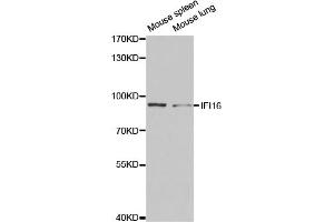 Western blot analysis of extracts of various cell lines, using IFI16 antibody (ABIN5971048) at 1/1000 dilution. (IFI16 anticorps)