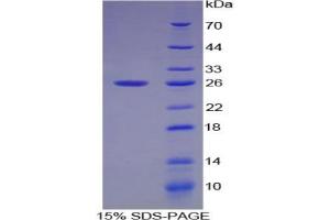 SDS-PAGE analysis of Cow Smad1 Protein. (SMAD1 Protéine)