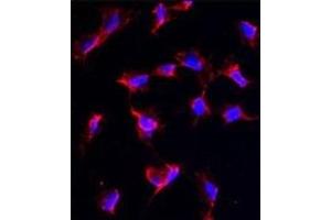 Immunofluorescence analysis of anti-NANOS1 Antibody (C-term) in HeLa cells. (Nanos Homolog 1 anticorps  (C-Term))