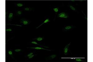Immunofluorescence of monoclonal antibody to PRDM1 on HeLa cell. (PRDM1 anticorps  (AA 422-493))