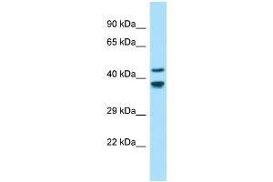 Western Blotting (WB) image for anti-Gliomedin (GLDN) (N-Term) antibody (ABIN2790542) (GLDN anticorps  (N-Term))