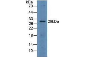 Detection of FOSL1 in Rat Spleen Tissue using Polyclonal Antibody to FOS Like Antigen 1 (FOSL1)