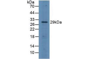 Detection of FOSL1 in Rat Spleen Tissue using Polyclonal Antibody to FOS Like Antigen 1 (FOSL1) (FOSL1 anticorps  (AA 1-271))