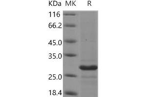 Western Blotting (WB) image for Membrane-Spanning 4-Domains, Subfamily A, Member 1 (MS4A1) protein (TRX tag) (ABIN7196975)