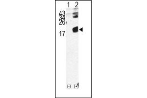 Image no. 1 for anti-beta-2-Microglobulin (B2M) (N-Term) antibody (ABIN357931) (beta-2 Microglobulin anticorps  (N-Term))