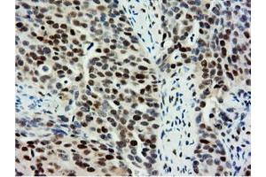 Immunohistochemical staining of paraffin-embedded Human Kidney tissue using anti-NT5DC1 mouse monoclonal antibody. (NT5DC1 anticorps)