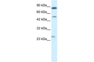 Western Blotting (WB) image for anti-Chloride Channel, Voltage-Sensitive 6 (CLCN6) antibody (ABIN2461139) (CLCN6 anticorps)