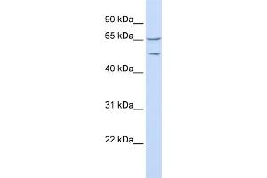 WB Suggested Anti-TTYH1 Antibody Titration:  0. (TTYH1 anticorps  (N-Term))