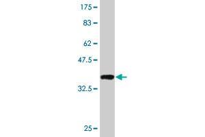 Western Blot detection against Immunogen (36. (EHMT1 anticorps  (AA 1-100))