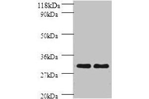 Western blot All lanes: HLA-DPB1 antibody at 2 μg/mL Lane 1: sw1990 whole cell lysate Lane 2: HGC27 whole cell lysate Secondary Goat polyclonal to rabbit IgG at 1/10000 dilution Predicted band size: 30 kDa Observed band size: 30 kDa (HLA-DPB1 anticorps  (AA 30-225))