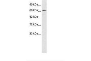 Image no. 1 for anti-Zinc Finger Protein 649 (ZNF649) (AA 436-485) antibody (ABIN202680) (ZNF649 anticorps  (AA 436-485))