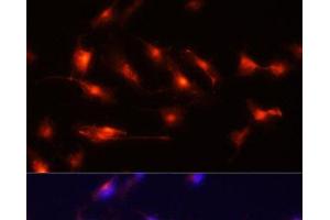 Immunofluorescence analysis of U-251MG cells using Nestin Polyclonal Antibody at dilution of 1:100 (20x lens).