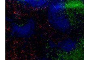 Immunofluorescence (IF) image for anti-Mannose Receptor, C Type 1 (MRC1) antibody (Alexa Fluor 594) (ABIN2656822)