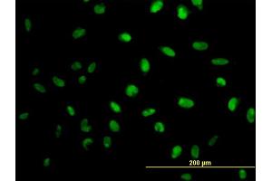 Immunofluorescence of monoclonal antibody to MPG on HeLa cell. (MPG anticorps  (AA 1-90))