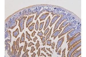 IHC analysis of RAB3GAP2 using anti-RAB3GAP2 antibody (ABIN6719633). (RAB3GAP2 anticorps  (AA 1-115))