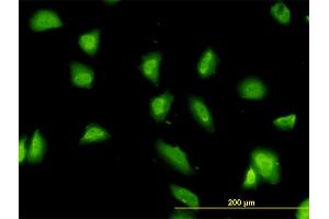 Immunofluorescence of monoclonal antibody to G3BP on HeLa cell. (G3BP1 anticorps  (AA 214-303))