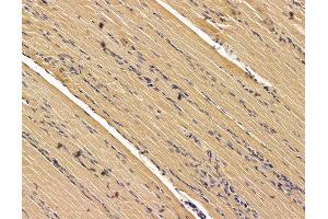 ABIN7095950 and ABIN7100012 at 1/100 staining rat muscle tissue by IHC-P. (SCYL3 anticorps)