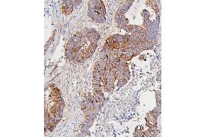 IHC analysis of CDK1 using anti-CDK1 antibody (ABIN7602240). (CDK1 anticorps  (AA 66-297))